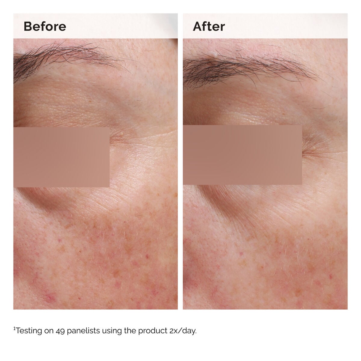 niacinamide-5-face-and-body-emulsion-l2 2024-08-23-ORD-Nia-5pct-Face-Body-B-A-Elasticity-Global-02-1x1.jpg