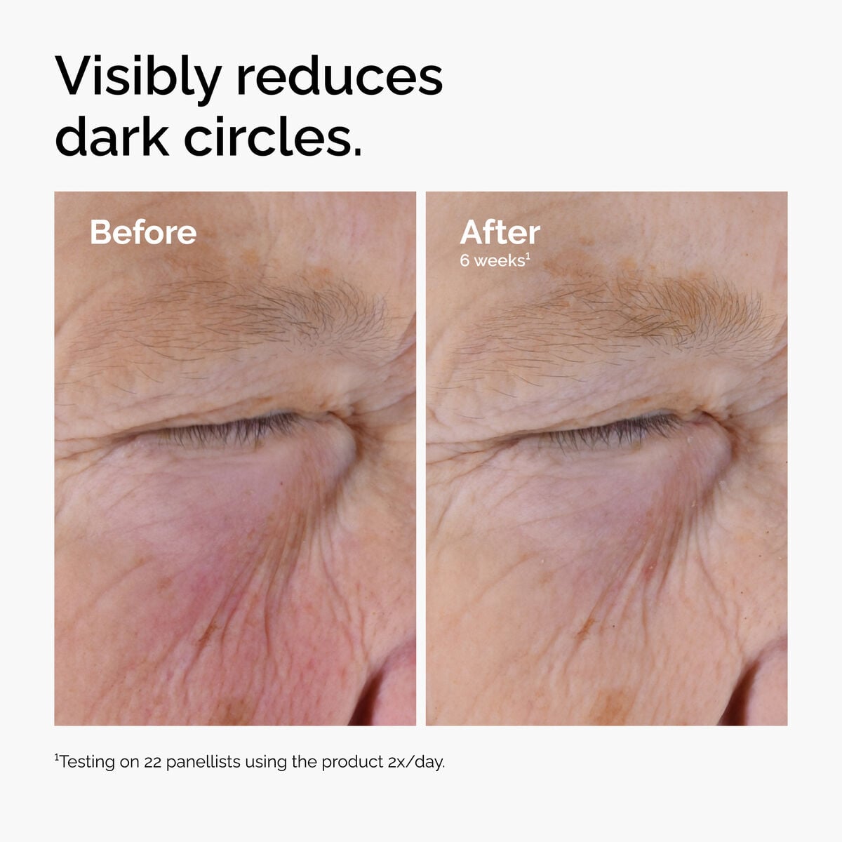 caffeine-solution-5-egcg-eye-serum-i4 ord-caffeine-solution-egcg-dark-circles-before-after.jpg