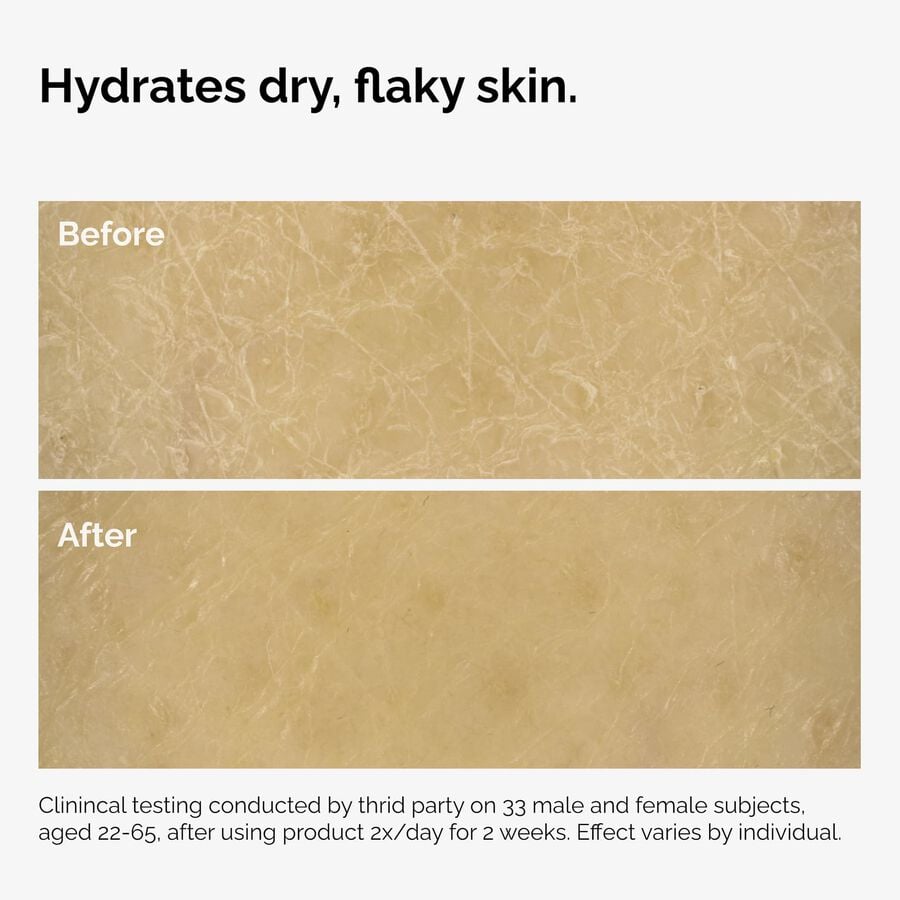 the-body-care-collection-v6 ord-natural-moisturizing-factors-inulin-body-before-after-graphic-02.jpg