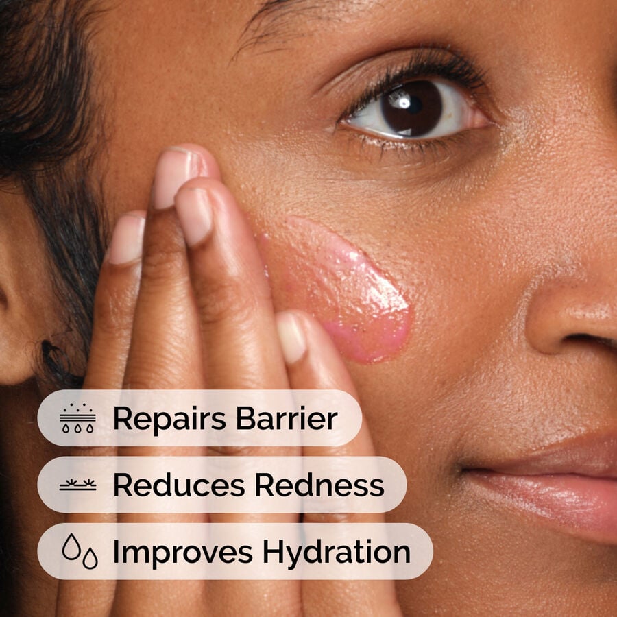 soothing-and-barrier-support-serum-set-v9 ord-soothing-barrier-support-serum-model-application-with-benefits.jpg