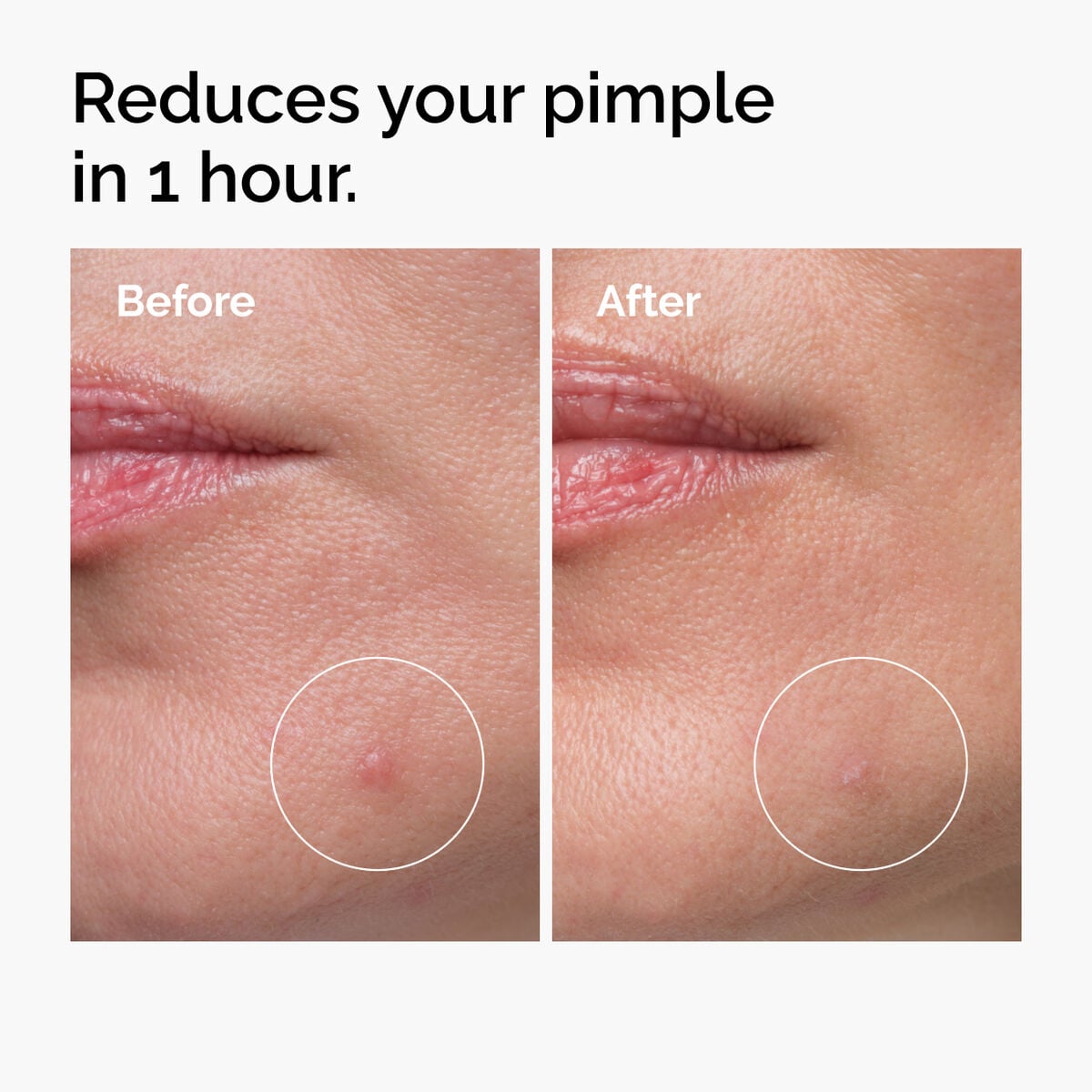sulfur-10-powder-to-cream-concentrate-f1 ord-sulfur-10pct-powder-to-cream-concentrate-before-after-NA.jpg