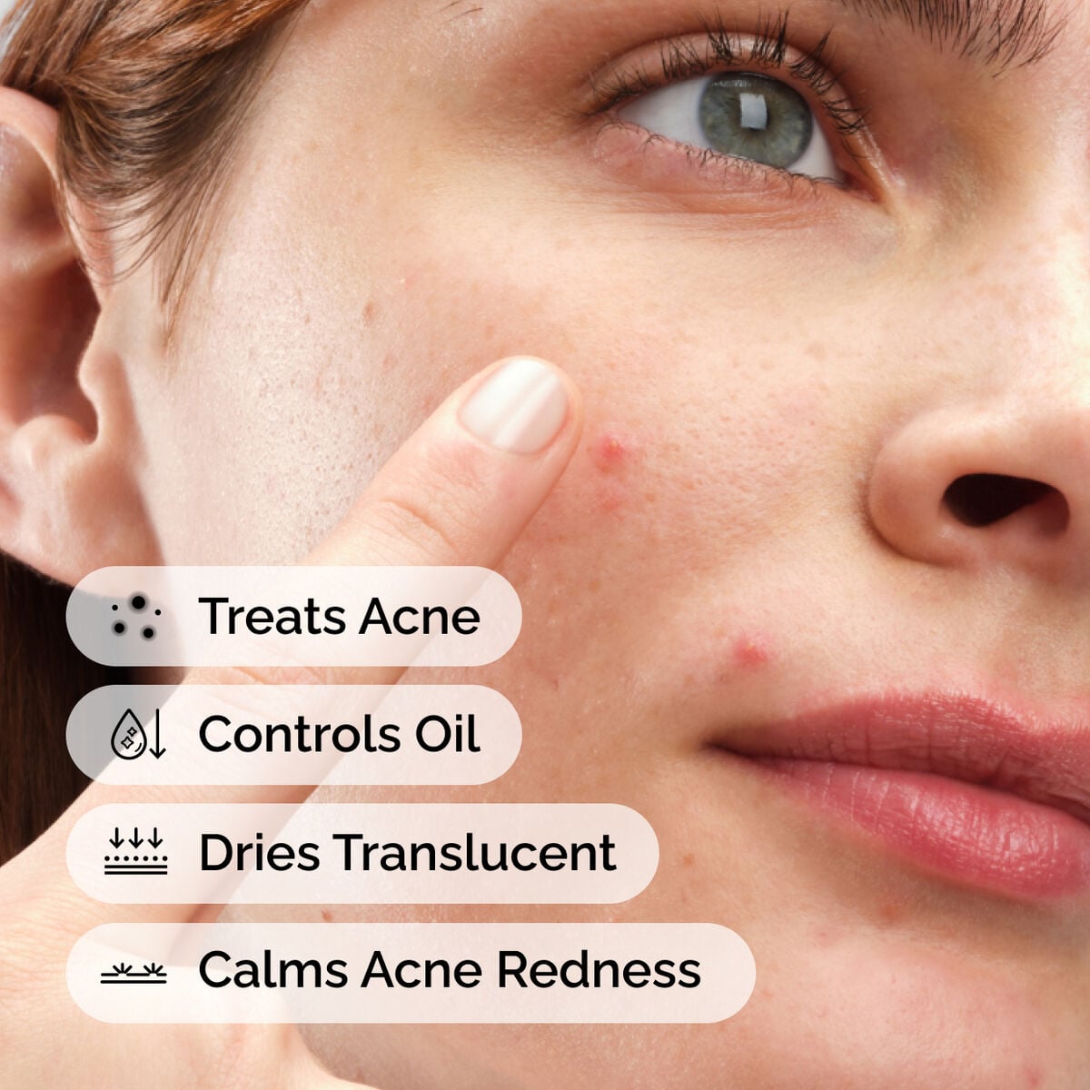 sulfur-10-powder-to-cream-concentrate-f1 ord-sulfur-10pct-powder-to-cream-concentrate-model-application-with-benefits-acne.jpg